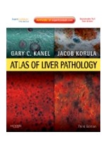 Atlas of Liver Pathology,3/e
