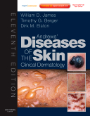 Andrews\' Diseases of the Skin, 11/e