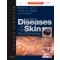 Andrews' Diseases of the Skin, 11/e