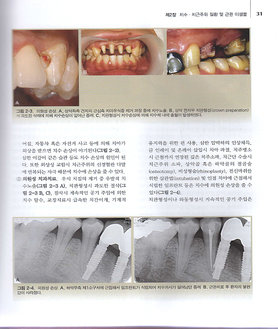 최신 근관치료학 (Textbook of Endodontology)