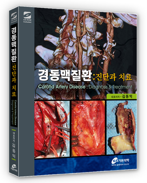 경동맥질환:진단과치료(DVD포함)