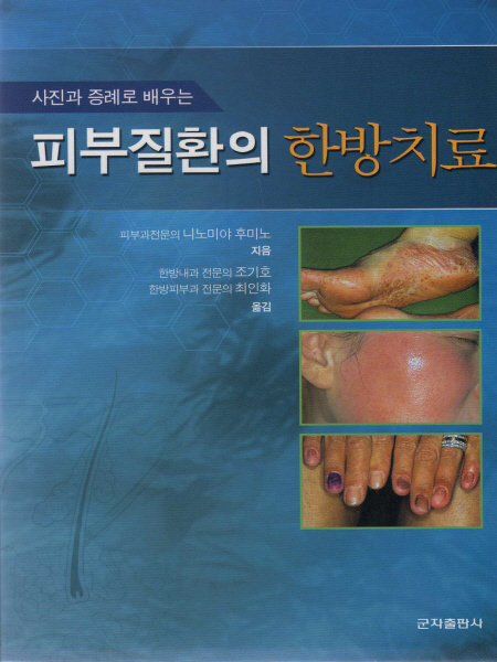 피부질환의 한방치료(사진과 증례로 배우는)