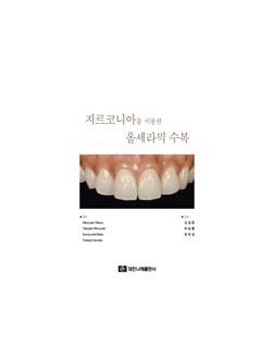 지르코니아를 이용한 올세라믹 수복