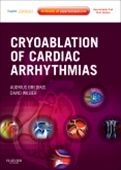 Cryoablation of Cardiac Arrhythmias