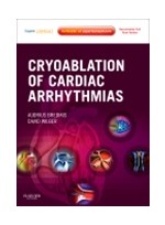 Cryoablation of Cardiac Arrhythmias