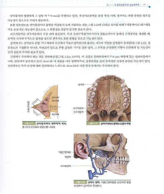 임플란트를 위한 치조골 재생술