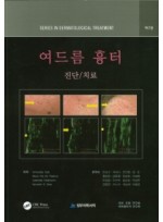 여드름 흉터 (진단/치료)   2판