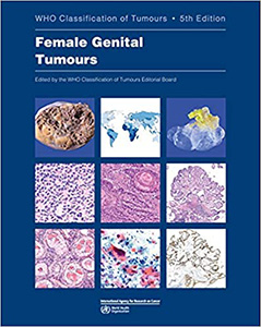 Female Genital Tumours 5e-WHO Classification of Tumours Vol 4