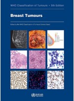 WHO Classification of Breast Tumours 5e