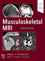 Musculoskeletal MRI 3e