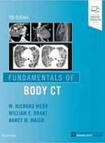 Fundamentals of Body CT 5e