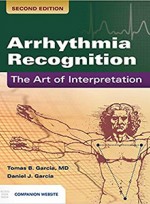 Arrhythmia Recognition: The Art of Interpretation 2e