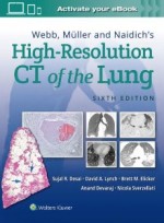 Webb, Müller and Naidich's High-Resolution CT of the Lung,6/e
