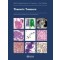 WHO Classification of Tumours Editorial Board