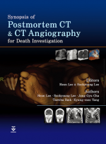 Synopsis of Postmortem CT and CT Angiography for Death Investigation