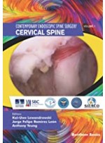 Cervical Spine (Contemporary Endoscopic Spine Surgery)