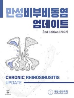 만성비부비동염 업데이트 2nd Edition