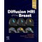 Diffusion MRI of the Breast