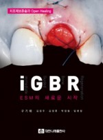 iGBR - ESM의 새로운 시작