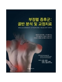 부정렬 증후군 : 골반 분석 및 교정 치료