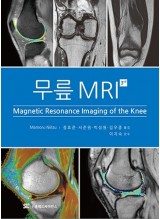 무릎 MRI 3판