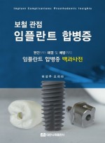 보철 관점 임플란트 합병증 - 원인부터 해결 및 예방까지 임플란트 합병증 백과사전