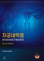 자궁내막증 2판