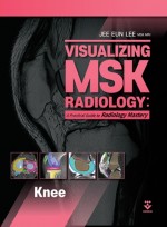 Visualizing MSK Radiology : A Practical Guide to Radiology Mastery