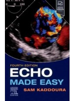 Echo Made Easy,4/e