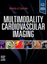 Multimodality Cardiovascular Imaging