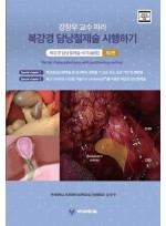 강창무 교수 따라 복강경 담낭절제술 시행하기 제2편-복강경 담낭절제술 비기