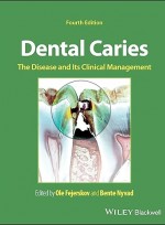 Dental Caries: The Disease and its Clinical Management 4e