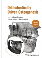 Orthodontically Driven Osteogenesis 2e