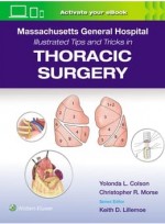 Massachusetts General Hospital Illustrated Tips and Tricks in Thoracic Surgery: Print + eBook with Multimedia