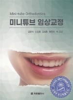 미니튜브 임상교정