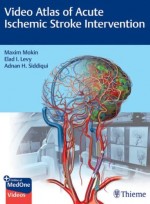 Video Atlas of Acute Ischemic Stroke Intervention