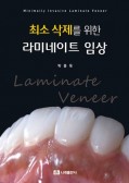 최소 삭제를 위한 라미네이트 임상