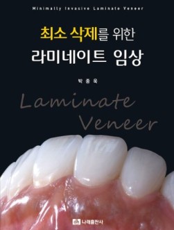 최소 삭제를 위한 라미네이트 임상