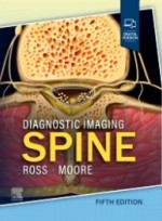 Diagnostic Imaging: Spine 5e