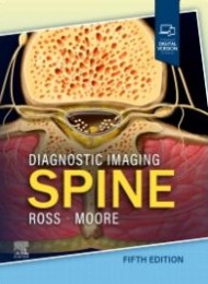 Diagnostic Imaging: Spine 5e
