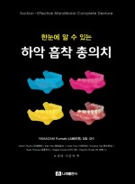 한눈에 알 수 있는 하악 흡착 총의치