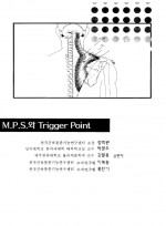 MPS와 Trigger Point