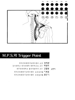 MPS와 Trigger Point