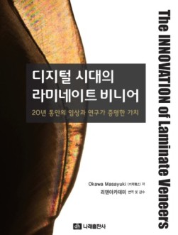 디지털 시대의 라미네이트 비니어