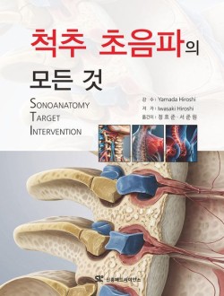 척추 초음파의 모든것