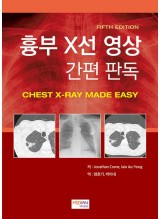 흉부 X선 영상 간편 판독 (Chest X-Ray Made Easy)