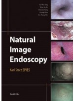 Natural Image Endoscopy - Karl Storz SPIES
