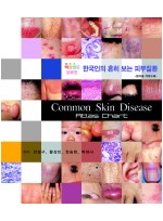한국인의 흔히 보는 피부질환(환자용 가이드북)