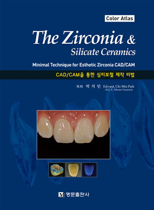 The Zirconia & Silicate Ceramics -CAD/CAM을 통한 심미보철 제작 비법