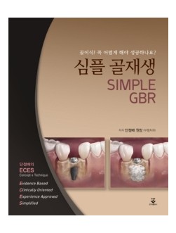 심플 골재생 (SIMPLE GBR)